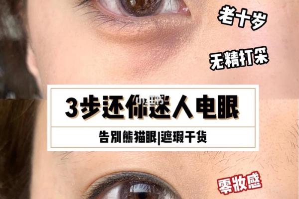 怎么去八字纹 怎么去八字纹