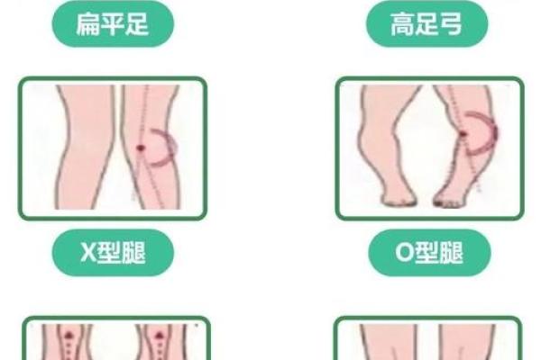 内八字和外八字 内八字和外八字