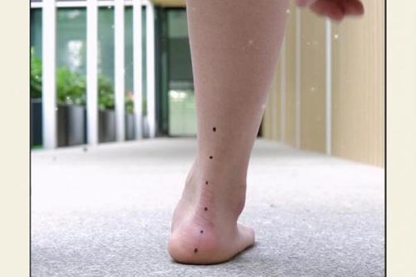 内八字和外八字 内八字和外八字