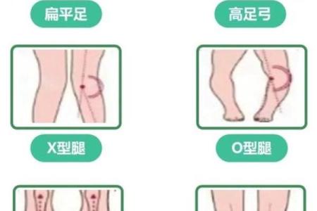 内八字和外八字