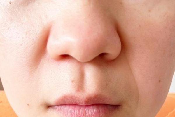 八字纹,八字纹是什么样子图片 八字纹,八字纹是什么样子图片