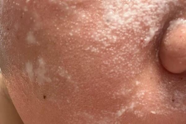 脸上长毛风水 脸上长毛风水