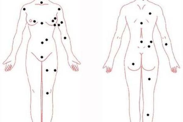 背上的痣图解算命 背上的痣图解算命