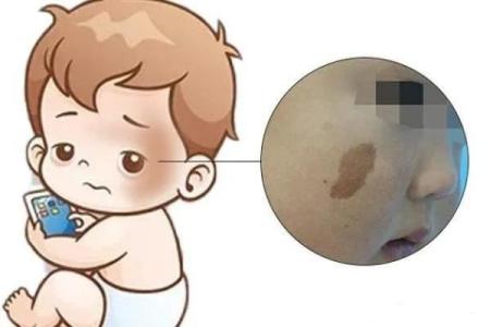 面部不同位置的胎记算命