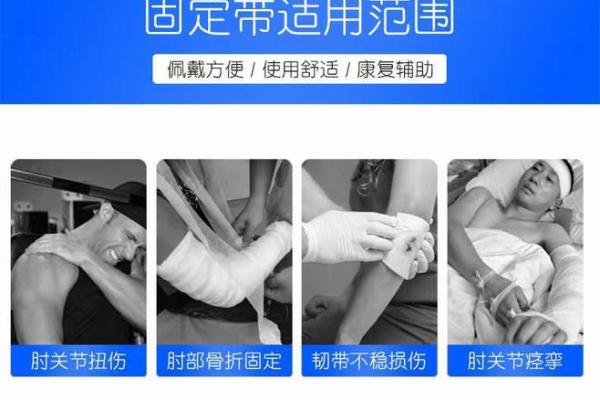 八字包扎法