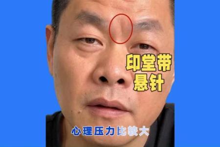 眉心八字纹的男人面相