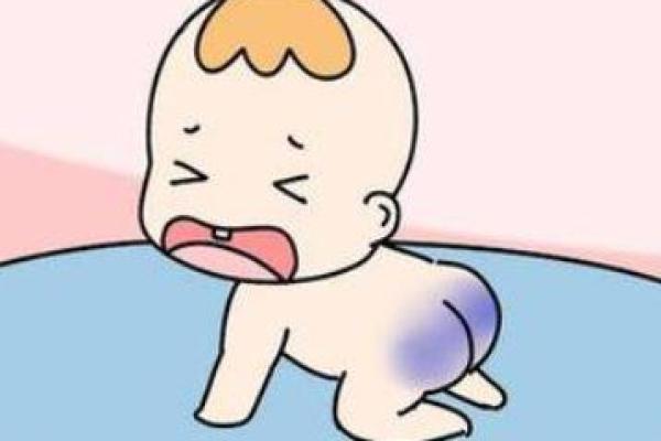 胎记如何算命-