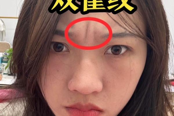 眉心凸起八字纹分析及治疗方法,了解眉心凸起八字纹原因 眉心凸起八字纹分析及治疗方法,了解眉心凸起八字纹原因