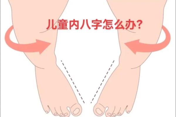内八字、外八字孩子脚型正常不正常，家长可以这么判断