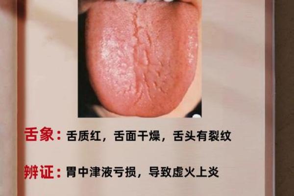 算命要防口舌是什么意思 算命要防口舌是什么意思