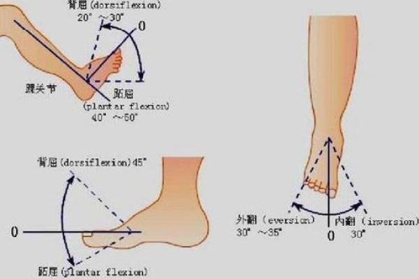 踝关节八字 踝关节八字