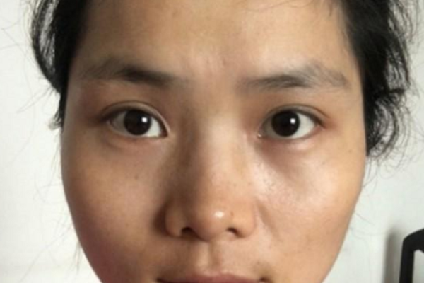 风水上印堂发黑是不是跟了鬼 风水上印堂发黑是不是跟了鬼