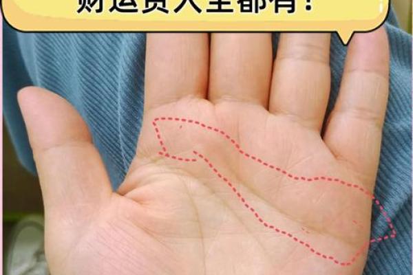 算命的说，手腕上有这样的纹路，一定会破财！