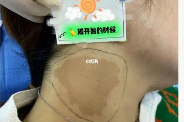 脖子上不同位置胎记算命