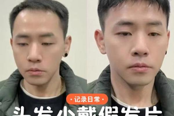 头发稀少的八字特征 八字头发稀少