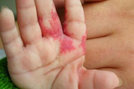 胎记算命胎记的位置与命运