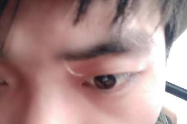 脸上长白毛的算命说法 脸上有白毛的人能算命吗