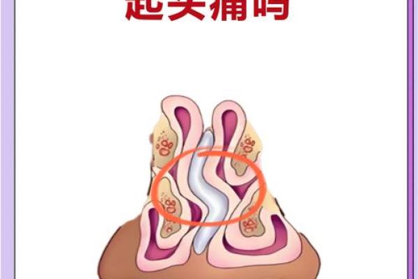 为什么说大鼻子女人不能要风水观点 为什么说大鼻子女人不能要风水观点